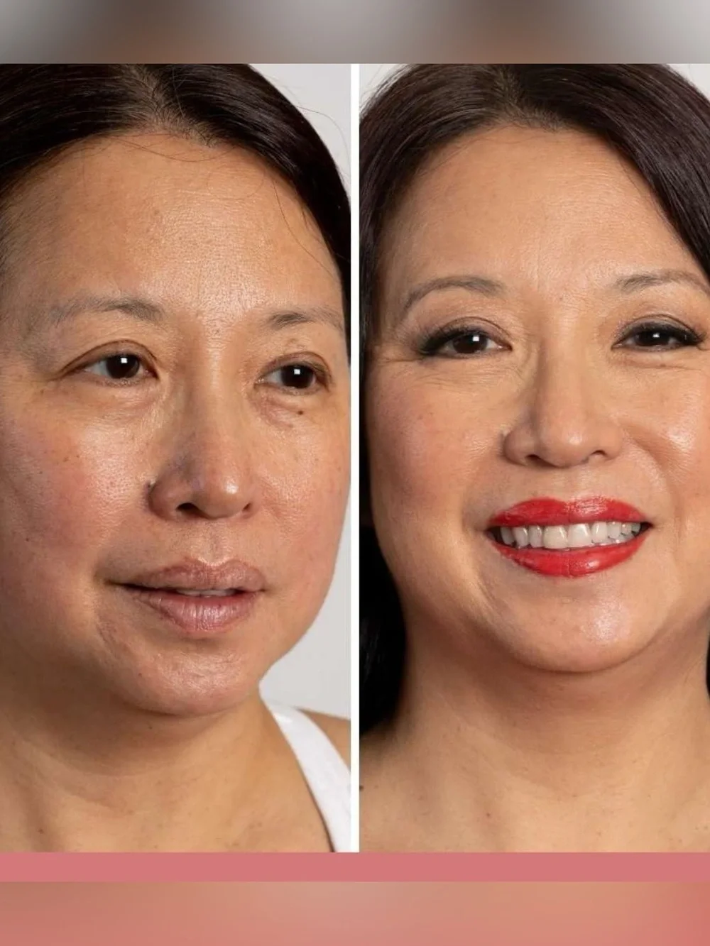 Jerome Alexander undereye tightener